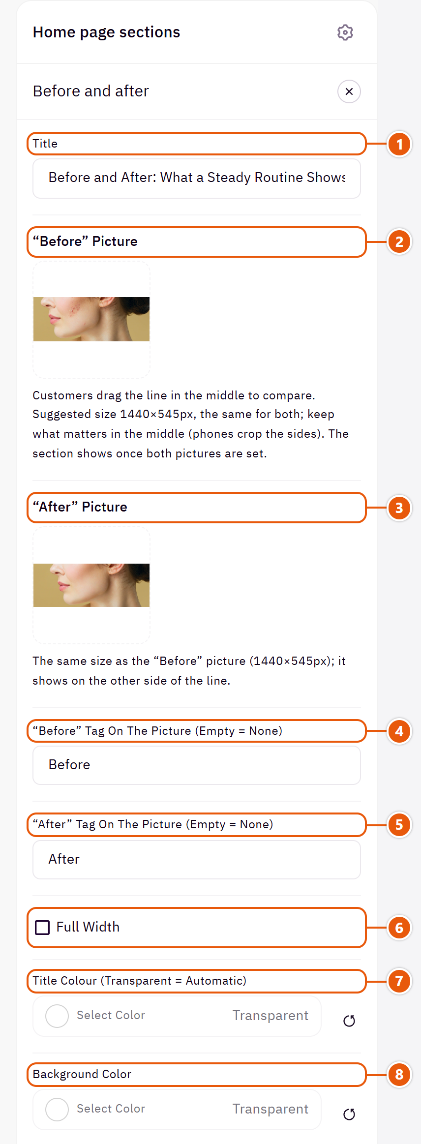 “Before and after” settings in the Zid editor (1 of 2)