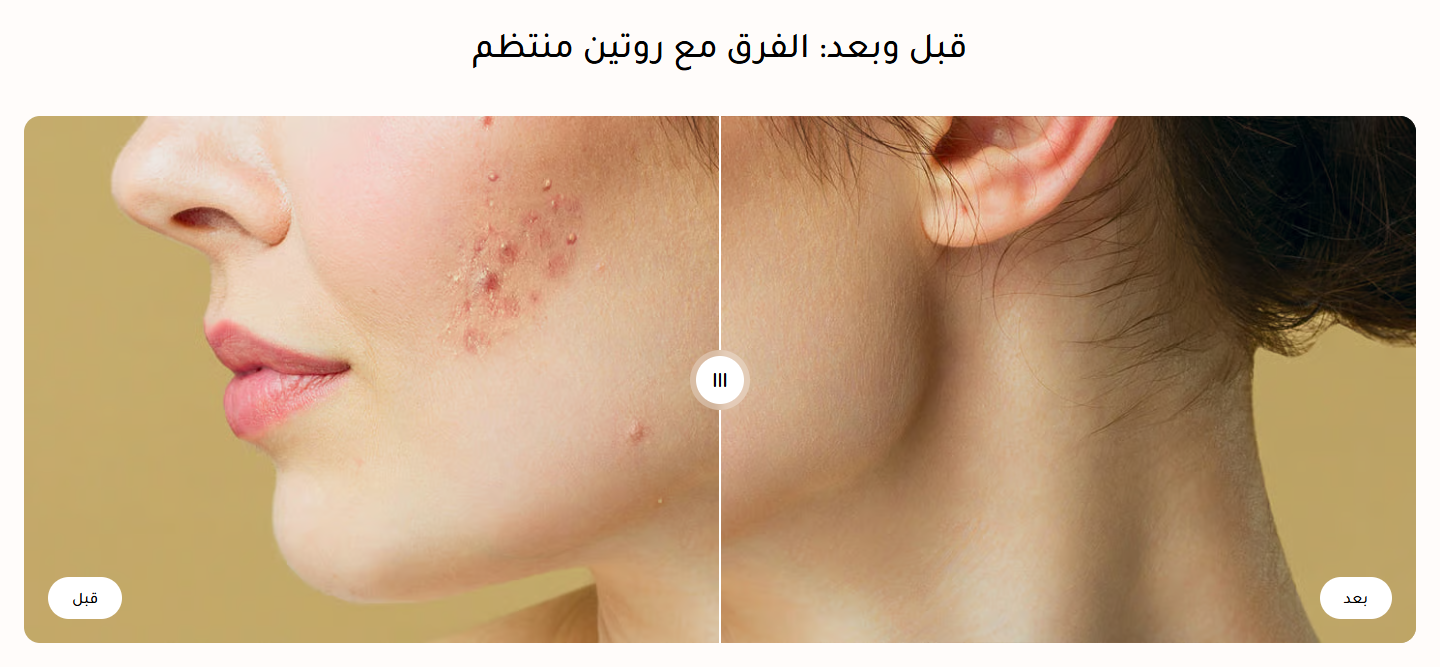 مقارنة قبل وبعد